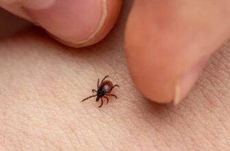 Бореліоз: симптоми