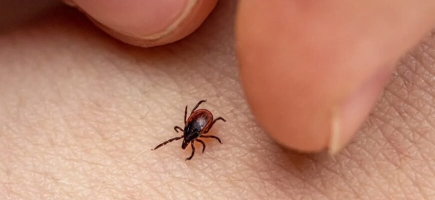 Бореліоз: симптоми