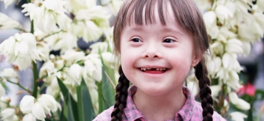 Що таке даун: Визначення