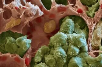 Розкриття поняття метастазів: причини