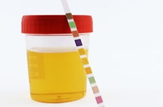 Причини та ознаки олігурії: як розпізнати зменшення сечовипускання