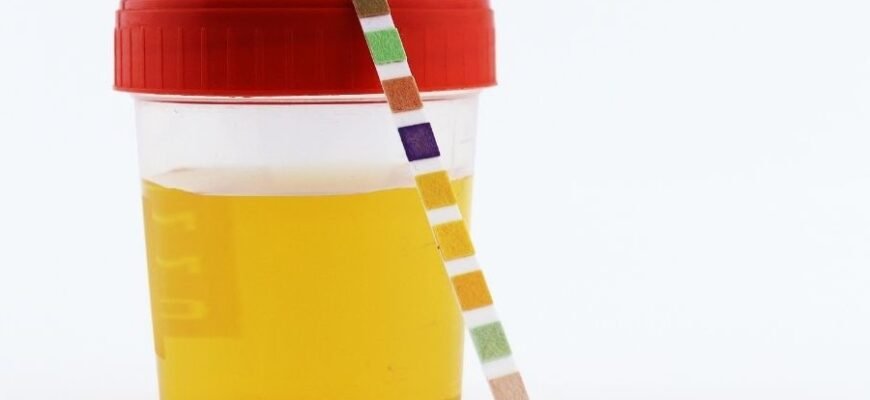 Причини та ознаки олігурії: як розпізнати зменшення сечовипускання