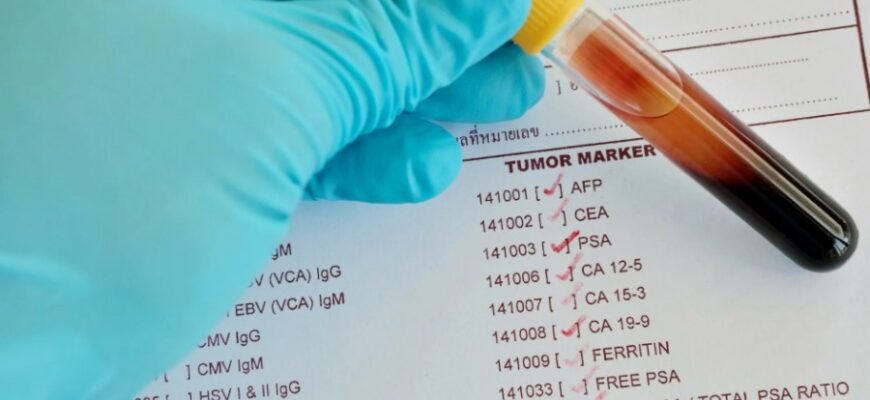 Дізнайтеся