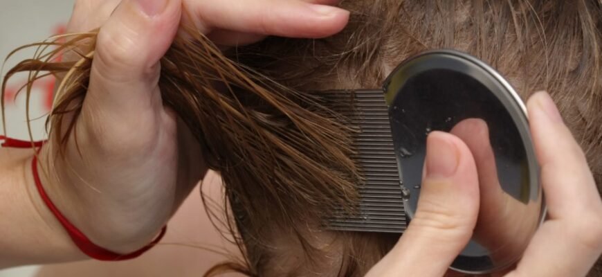 Що таке педикульоз: причини