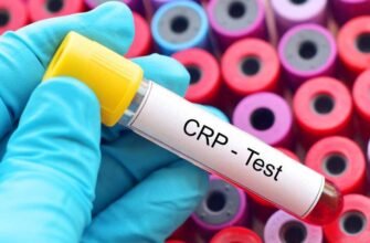Реактивний білок: Що це таке та яку роль відіграє в організмі?