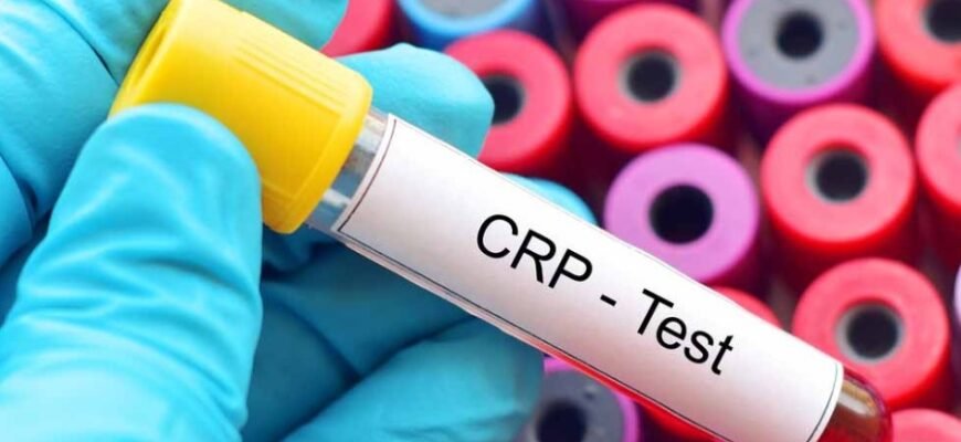 Реактивний білок: Що це таке та яку роль відіграє в організмі?