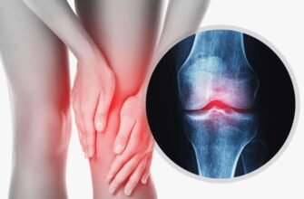 Артроз: що це таке