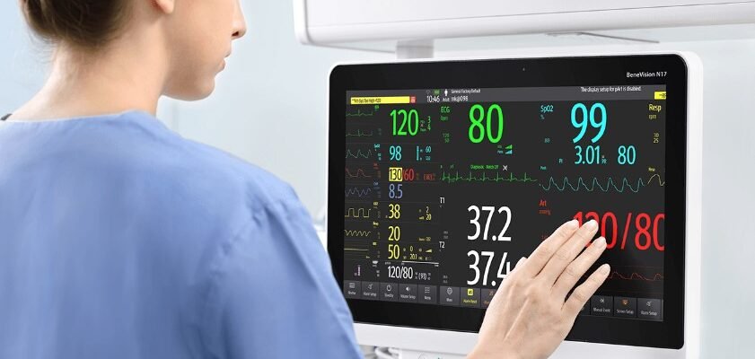 Монітор пацієнта: особливості вибору та застосування в медицині