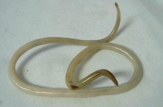 Аскаридоз: Симптоми