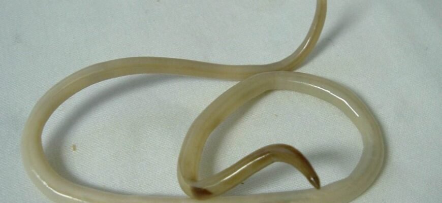 Аскаридоз: Симптоми