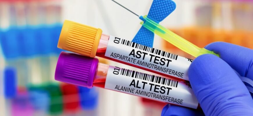 Аспартатамінотрансфераза: роль ферменту в діагностиці захворювань