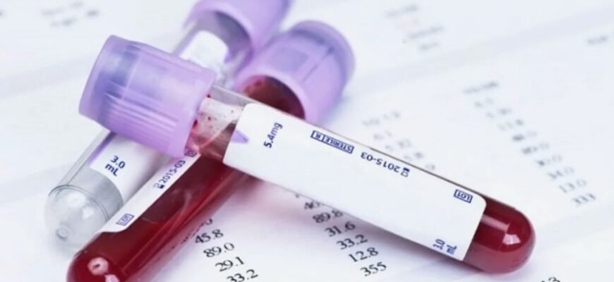 Що таке АТПО: Розуміння автовиробництва та його переваг