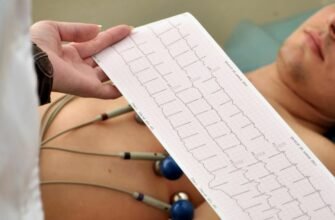 Що таке ЕКГ: Розшифровка електрокардіограми для діагностики серця