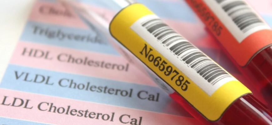 Гіперхолестеринемія: причини