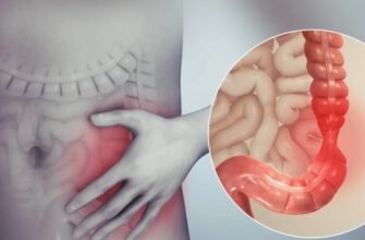 Що таке кишкова непрохідність: причини