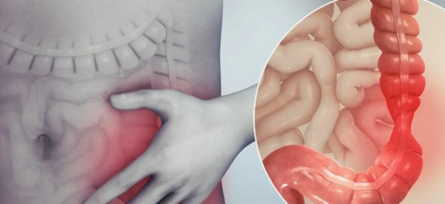 Що таке кишкова непрохідність: причини