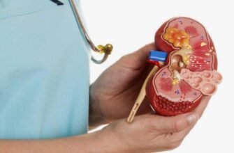 Кіста нирки: причини