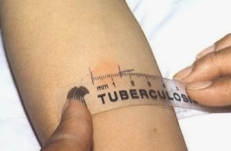 Манту: Що це таке