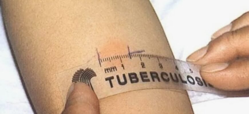 Манту: Що це таке