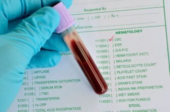 Що таке низький гемоглобін: причини